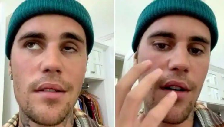 Yüz felci geçiren Justin Bieber, turuna kaldığı yerden devam edecek